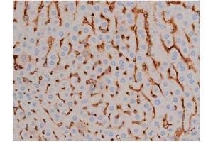 Immunohistochemistry (IHC) image for anti-Synuclein, alpha (SNCA) (pSer129) antibody (ABIN6254965)