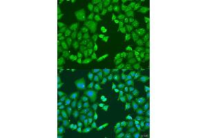 Immunofluorescence analysis of U2OS cells using CYP11B1 antibody (ABIN6292452) at dilution of 1:100. (CYP11B1 抗体)