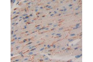 Used in DAB staining on fromalin fixed paraffin- embedded heart tissue (GABBR1 抗体  (AA 199-570))
