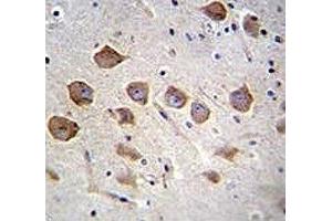 KCNRG antibody analysis in formalin fixed and paraffin embedded human brain tissue. (KCNRG 抗体  (AA 175-202))