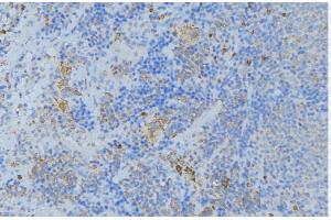 ABIN6277009 at 1/100 staining Human lymph node tissue by IHC-P. (Periostin 抗体  (N-Term))