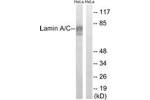 Western blot analysis of extracts from HeLa cells, treated with paclitaxel 1uM 24h, using Lamin A (Ab-22) Antibody. (Lamin A/C 抗体  (AA 2-51))