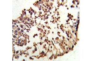 IHC analysis of FFPE human testis tissue stained with Retinoblastoma antibody