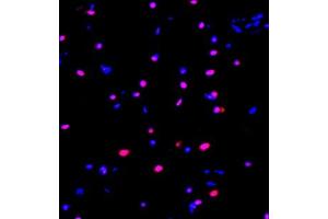Immunofluorescence (Paraffin-embedded Sections) (IF (p)) image for anti-Zinc Finger Protein 682 (ZNF682) antibody (ABIN7076270)