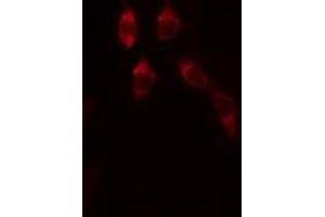 ABIN6272464 staining Hela by IF/ICC. (WDHD1 抗体  (Internal Region))