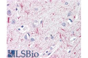 ABIN571068 (10µg/ml) staining of paraffin embedded Human Cortex. (Deltex Homolog 3 抗体  (Internal Region))