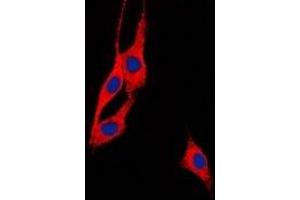 Immunofluorescent analysis of BEGAIN staining in Hela cells. (BEGAIN 抗体  (C-Term))