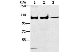 Western Blot analysis of Human fetal muscle tissue, A172 and K562 cell using ERK 5 Polyclonal Antibody at dilution of 1:250 (MAPK7 抗体)