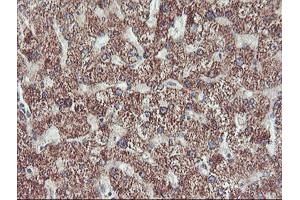 Immunohistochemical staining of paraffin-embedded Human liver tissue using anti-PECI mouse monoclonal antibody. (PECI/ECI2 抗体)