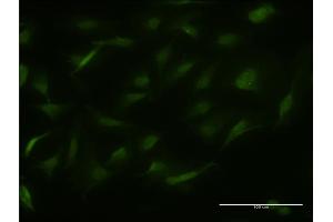 Immunofluorescence of monoclonal antibody to RALGPS2 on HeLa cell. (RALGPS2 抗体  (AA 282-386))