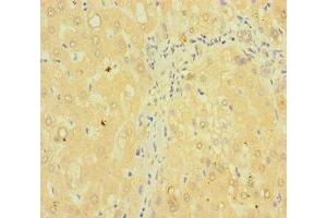 Immunohistochemistry of paraffin-embedded human liver tissue using ABIN7173003 at dilution of 1:100 (TMPRSS11B 抗体  (AA 201-416))