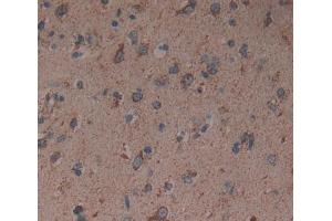 Immunohistochemistry (IHC) image for anti-gamma-aminobutyric Acid (GABA) A Receptor, alpha 2 (GABRA2) (AA 42-250) antibody (ABIN7437632)