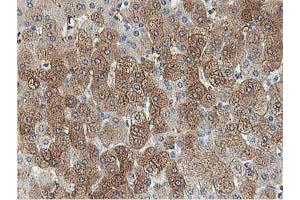 Image no. 3 for anti-Aldolase B, Fructose-Bisphosphate (ALDOB) antibody (ABIN1496605) (ALDOB 抗体)