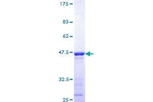 CUX1 Protein (AA 521-620) (GST tag)