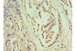 Immunohistochemistry of paraffin-embedded human prostate tissue using ABIN7155843 at dilution of 1:100 (OTX2 抗体  (AA 140-280))