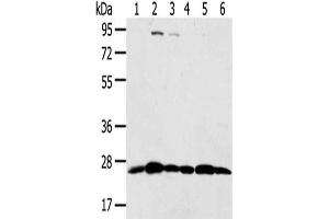 Gel: 8 % SDS-PAGE,Lysate: 40 μg,Lane 1-6: Hela cells, Raji cells, Jurkat cells, Human placenta tissue, A431 cells, 231 cells,Primary antibody: ABIN7192036(PSMB8 Antibody) at dilution 1/350 dilution,Secondary antibody: Goat anti rabbit IgG at 1/8000 dilution,Exposure time: 10 seconds (PSMB8 抗体)