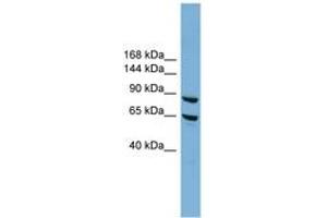 Image no. 1 for anti-Exocyst Complex Component 6 (EXOC6) (N-Term) antibody (ABIN6744168) (EXOC6 抗体  (N-Term))