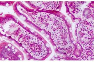 Image no. 1 for anti-Gasdermin A (GSDMA) (AA 223-272) antibody (ABIN6749791) (Gasdermin A 抗体  (AA 223-272))