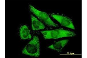 Immunofluorescence of purified MaxPab antibody to NACAL on HepG2 cell. (NACA2 抗体  (AA 1-215))