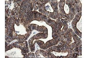 Image no. 7 for anti-Src-like-adaptor 2 (SLA2) antibody (ABIN1500949)