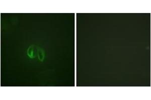 Immunofluorescence analysis of HepG2 cells, using IL-10R alpha (Ab-496) Antibody. (IL-10RA 抗体  (AA 462-511))