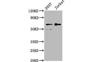 Western Blot Positive WB detected in: 293T whole cell lysate, Jurkat whole cell lysate All lanes: LILRB2 antibody at 4 μg/mL Secondary Goat polyclonal to rabbit IgG at 1/50000 dilution Predicted band size: 66, 65, 56, 52 kDa Observed band size: 66 kDa (LILRB2 抗体  (AA 406-563))
