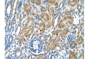 PARL antibody was used for immunohistochemistry at a concentration of 4-8 ug/ml. (PARL 抗体  (N-Term))