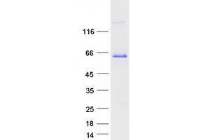 Western Blotting (WB) image for Paralemmin (PALM) (Transcript Variant 2) protein (Myc-DYKDDDDK Tag) (ABIN2728190)