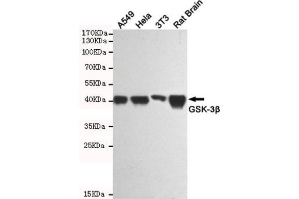 GSK3 beta 抗体