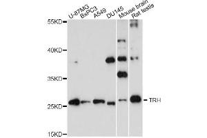 Western blot analysis of extracts of various cell lines, using TRH antibody. (TRH 抗体)