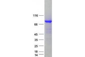 Western Blotting (WB) image for Kinesin Family Member 3A (KIF3A) protein (Myc-DYKDDDDK Tag) (ABIN2724243)