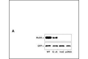 MuSK protein expression in extracts of COS cells after transfection with MuSK mutated and GFP constructs. (MUSK 抗体  (N-Term))