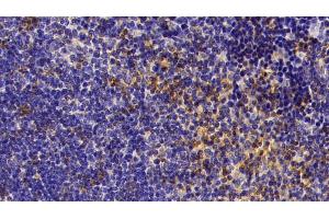 Immunohistochemistry (IHC) image for anti-serpin Peptidase Inhibitor, Clade A (Alpha-1 Antiproteinase, Antitrypsin), Member 1 (SERPINA1) (AA 25-413) antibody (ABIN7429055)