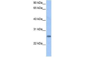 LOC730950 antibody used at 0. (LOC728743 抗体  (C-Term))