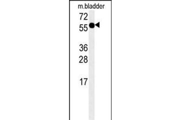 ADSSL1 抗体  (N-Term)