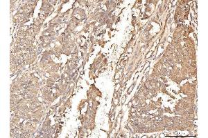 IHC analysis of BHMT using anti-BHMT antibody (ABIN7599940). (BHMT 抗体  (AA 13-386))