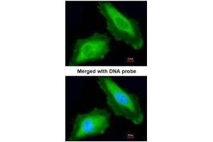 Immunofluorescence (IF) image for anti-DEAD (Asp-Glu-Ala-Asp) Box Polypeptide 3, X-Linked (DDX3X) (Center) antibody (ABIN2856700)