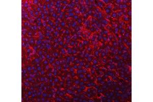 IF analysis of Tim 2/Timd2 using anti-Tim 2/Timd2 antibody (ABIN7602933).