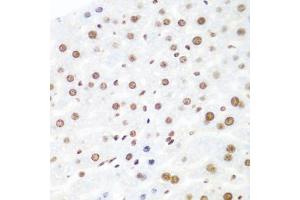 Immunohistochemistry of paraffin-embedded mouse liver using Argonaute-2 antibody (ABIN6133693, ABIN6140045, ABIN6140047 and ABIN6221669) at dilution of 1:100 (40x lens). (AGO2 抗体  (AA 1-100))