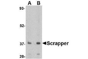 Image no. 1 for anti-F-Box and Leucine-Rich Repeat Protein 20 (FBXL20) (N-Term) antibody (ABIN1494347) (FBXL20 抗体  (N-Term))