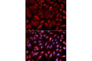 Immunofluorescence analysis of U2OS cells using SDCBP antibody. (SDCBP 抗体)