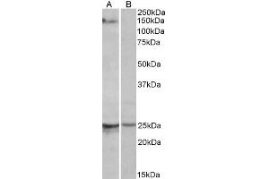 ABIN571262 (1µg/ml) staining of Mouse Heart lysate (35µg protein in RIPA buffer) with (B) and without (A) blocking with the immunising peptide. (RBM20 抗体  (AA 717-727))