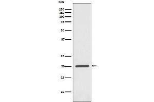 Western blot analysis of Ferritin expression in Jurkat cell lysate. (Recombinant Ferritin 抗体)