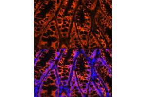 Immunofluorescence (IF) image for anti-Y Box Binding Protein 1 (YBX1) (AA 100-200) antibody (ABIN6150328)
