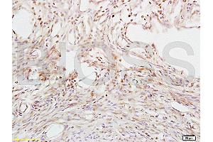 Formalin-fixed and paraffin embedded mouse uterus tissue labeled with Anti-ABP/SHBG Polyclonal Antibody, Unconjugated (ABIN739860) at 1:200 followed by conjugation to the secondary antibody and DAB staining (SHBG 抗体  (AA 51-150))