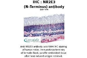Image no. 1 for anti-Nuclear Receptor Subfamily 2, Group E, Member 3 (NR2E3) (N-Term) antibody (ABIN1737506) (NR2E3 抗体  (N-Term))