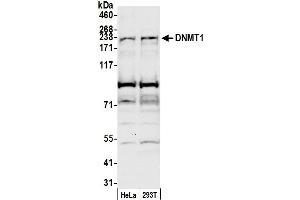 Western Blotting (WB) image for anti-DNA (Cytosine-5)-Methyltransferase 1 (DNMT1) (AA 700-750) antibody (ABIN7451553)