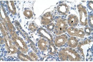 Human kidney (RNF165 抗体  (Middle Region))