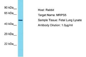 Host: Rabbit Target Name: MRPS5 Sample Type: Fetal Lung lysates Antibody Dilution: 1.
