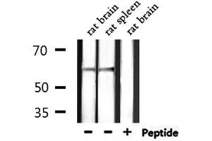 Western Blotting (WB) image for anti-Solute Carrier Family 9 (Sodium/hydrogen Exchanger), Member 8 (SLC9A8) (C-Term) antibody (ABIN6258404)